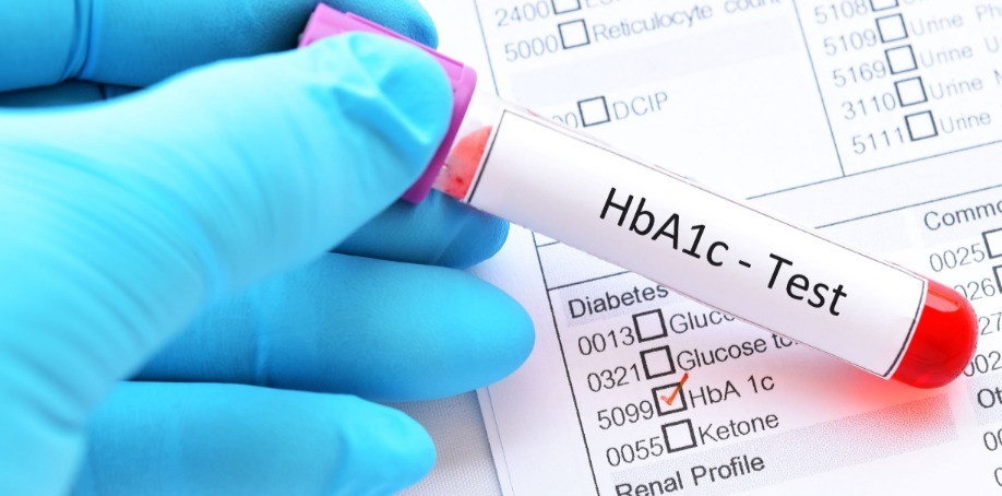 HbA1c Test